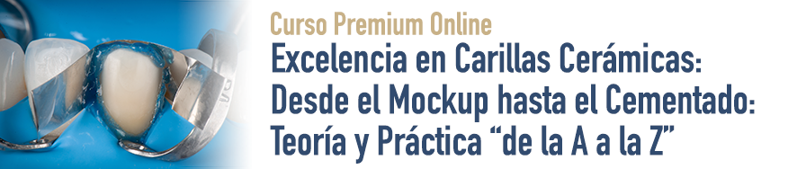 Excelencia en Carillas Cerámicas: Desde el Mockup hasta el Cementado: Teoría y Práctica “de la A a la Z”